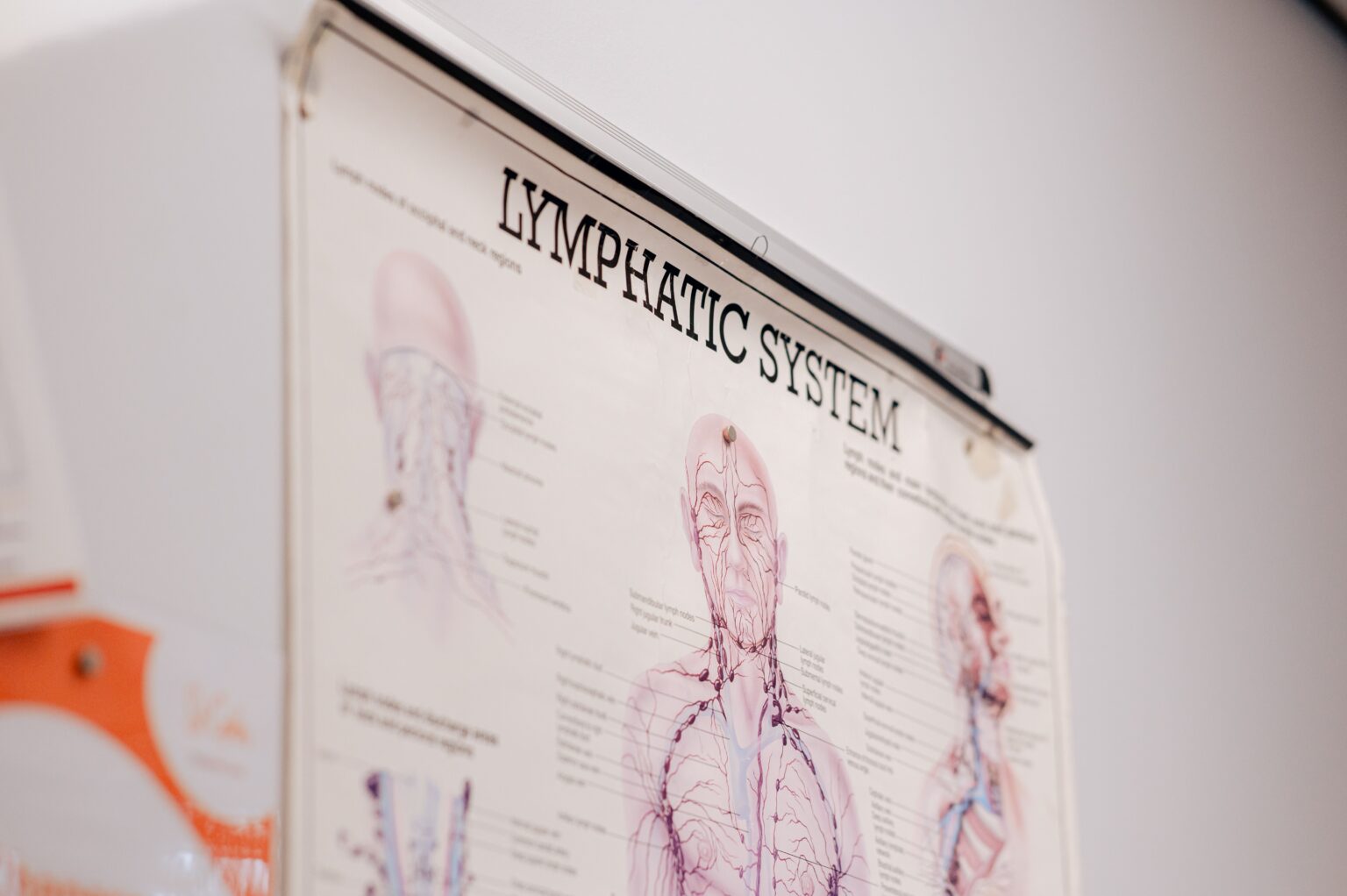 Lymphedema Clinic Near Me Expert Lymphedema Treatment